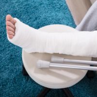 BrokenLegCast